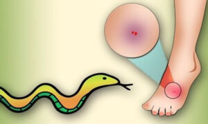 বছরে সাপের কামড়ে সাড়ে ৭ হাজারের বেশি মানুষের মৃত্যু: এনসিডিসির জরিপ