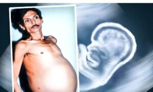 পৃথিবীর একমাত্র গর্ভবতী/গর্ভবান পুরুষ