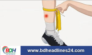 নাটোরে সাপে দৃংশনে যুবকের মৃত্যু