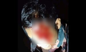 পাটগ্রামে চোরাকারবারিদের হামলায় বিজিবি সদস্য আহত ১