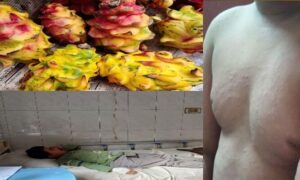 খুলনায় ড্রাগন ফল খেয়ে ছোট বাচ্চা অসুস্থ